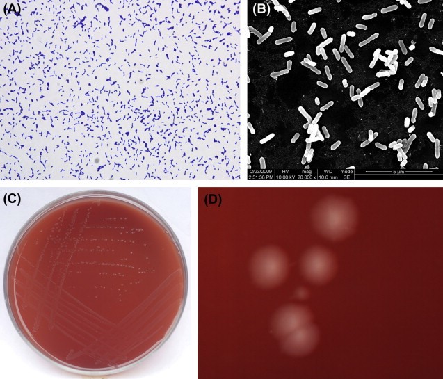 Eubacterium spp. Eubacterium limosum. Eubacterium rectale. Eubacterium под микроскопом. Eubacterium hallii под микроскопом.